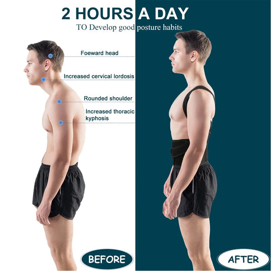 AlignBack™ Posture Corrector